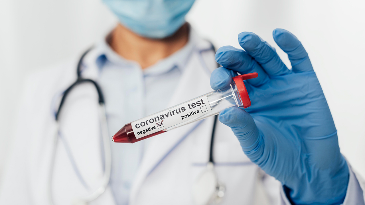 Teste rápido para diagnóstico da Covid-19.